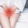 Dấu Hiệu Viêm Phụ Khoa Nhẹ: Nhận Biết Sớm và Giải Pháp Hiệu Quả